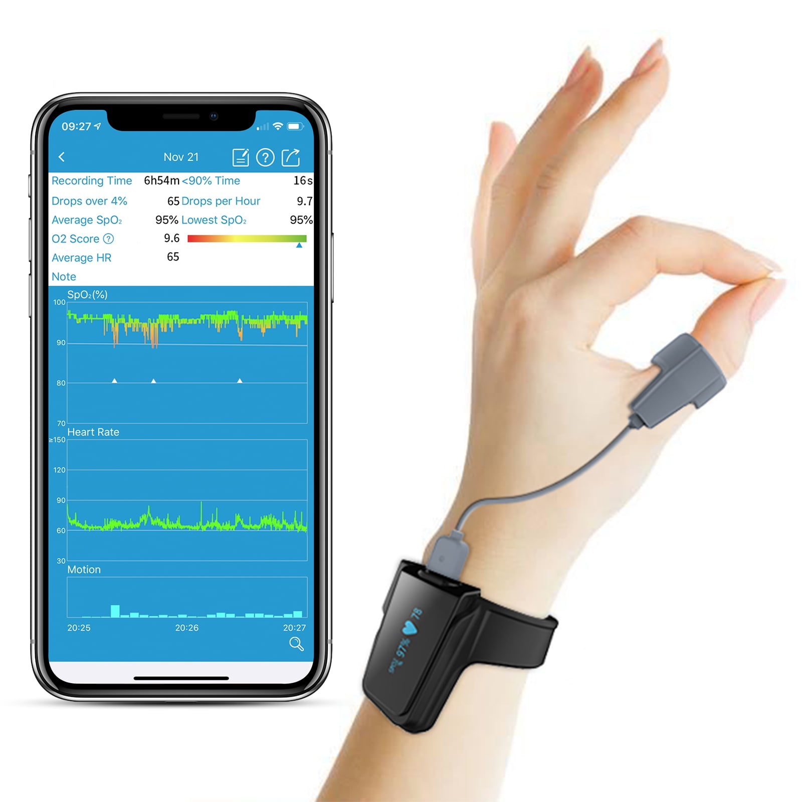 pulse oximeter garmin 935