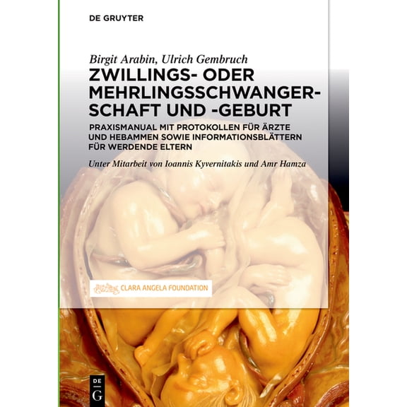 Schwangerschaft, Geburt und Wochenbett von Zwillingen und höhergradigen Mehrlingen, (Hardcover)