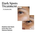 thumbnail image 2 of Serum MATKAS, eliminador de manchas oscuras coreano para rostro, 2 of 7