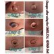 thumbnail image 4 of Umbilical Hernia Belt For Babies, Medical Child Belly Band Infant Abdominal Binder, Newborn Baby Hernia Support Truss Kids Navel Belly Button Band - S, 4 of 5