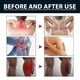 thumbnail image 4 of Joint Pain Cream relieves pain in joints, knees, cervical spine, lumbar spine, hands and feet, body care cream | |-4007594266658, 4 of 5