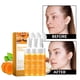 thumbnail image 5 of Limpiador facial 3 piezas Limpiador de cúrcuma Limpiador hidratante facial Limpia Reducir poros Refrescante Aclarar manchas Uniformizar tono Reducir imperfecciones Hacer más brillante Limpiador facial, 5 of 5