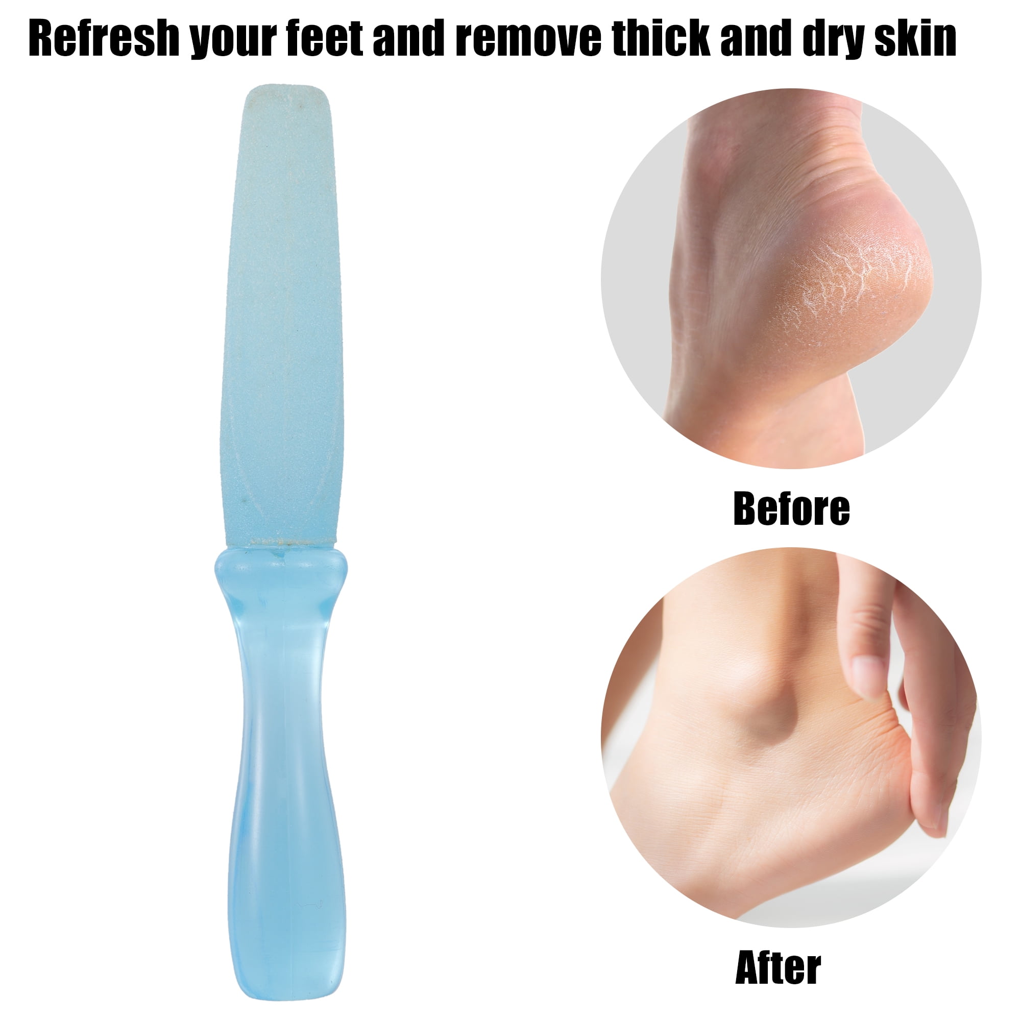 Unique Bargains 1Pc Foot File Removes Dead Skin Pedicure Foot Scrubber Dead  Skin Remover Pink ABS
