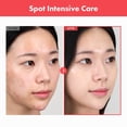 thumbnail image 2 of Crema TOSOWOONG Ovalicin Skin Clear con niacinamida 50 g, 2 of 7