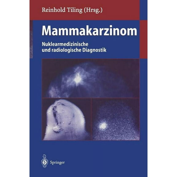Mammakarzinom: Nuklearmedizinische Und Radiologische Diagnostik, (Paperback)