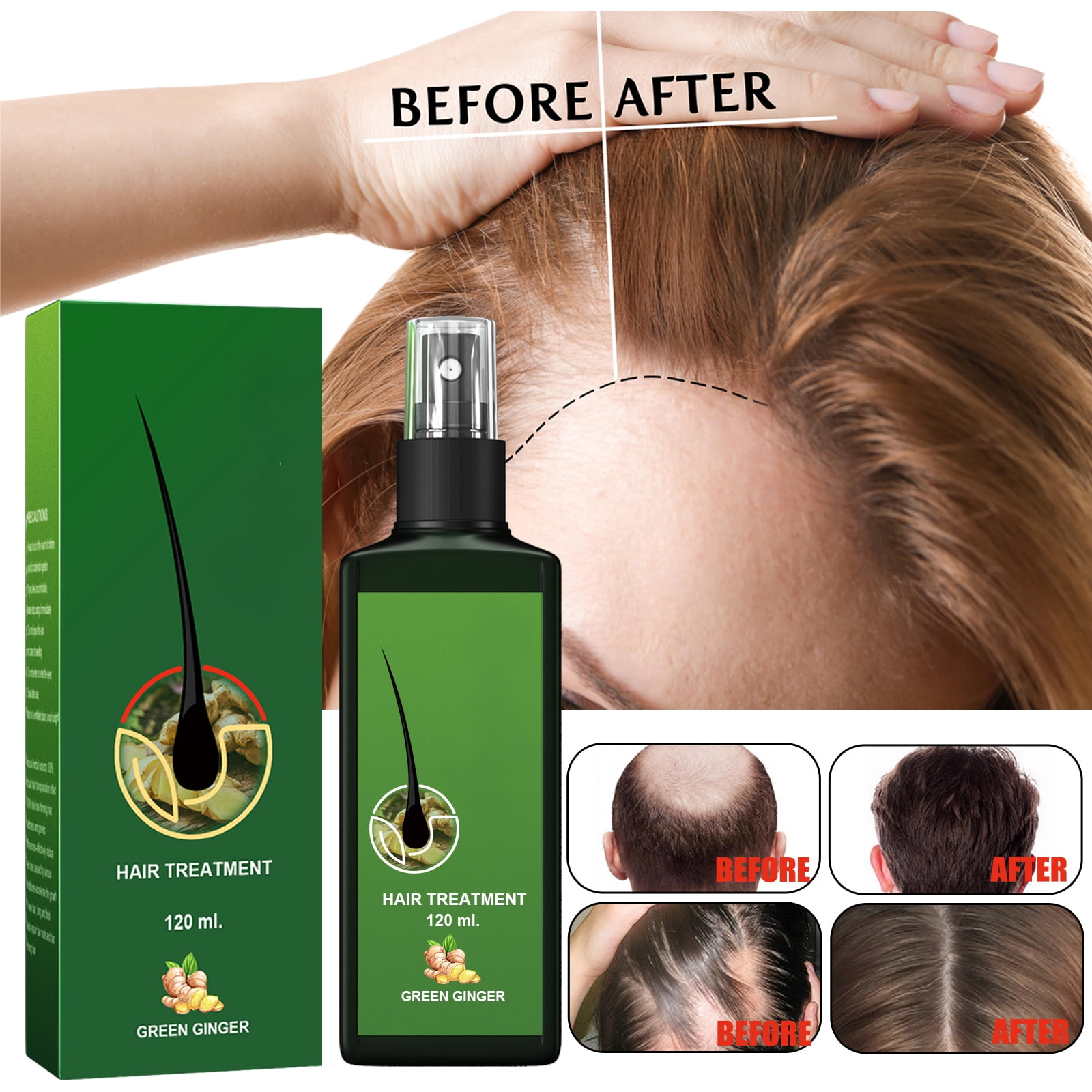 Alvantor Ginger Hair Growth Serum for Strengthening & Nourishing, 4.05 fl oz