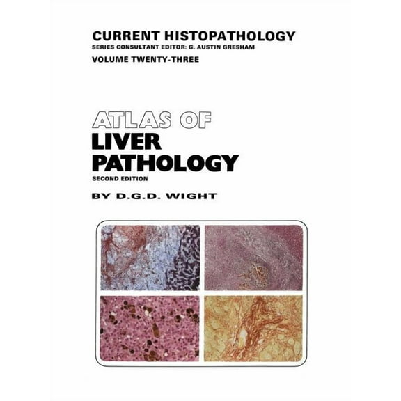 Current Histopathology Atlas of Liver Pathology, Book 23, (Paperback)