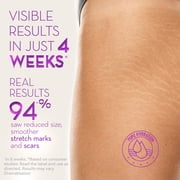 Cicatricure Cica Oil for Stretch Marks & Scars, Vitamin E Body Oil, Visible Results in 4 Weeks, 6.7 fl oz (1 Pack)