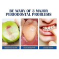 thumbnail image 2 of SOUTH MOON Gingival Fixation Toothpaste Curing Teeth Soothing Gingival Pa, 2 of 3