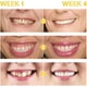 thumbnail image 4 of Gum Regrowth Essence 7 Gum Serum Gum Therapy Gel Gum Restore Gum, 4 of 5