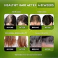 thumbnail image 4 of Batana Oil for Hair Growth - Cold-Pressed & Pure Unrefined Batana Oil Hair Mask for Women & Men - Enhances Hair Thickness, Prevents Loss, Repairs Spli, 4 of 5
