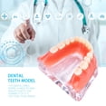 thumbnail image 3 of Modelo de sobredentadura, modelo de estudio de dientes dentales, modelo de estudio de dientes dentales, modelo de estudio dental confiable y duradero, 3 of 8