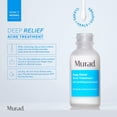 thumbnail image 3 of Tratamiento para el acné Murad Deep Relief Acne Control, 30 ml, 2% de ácido salicílico, 3 of 8