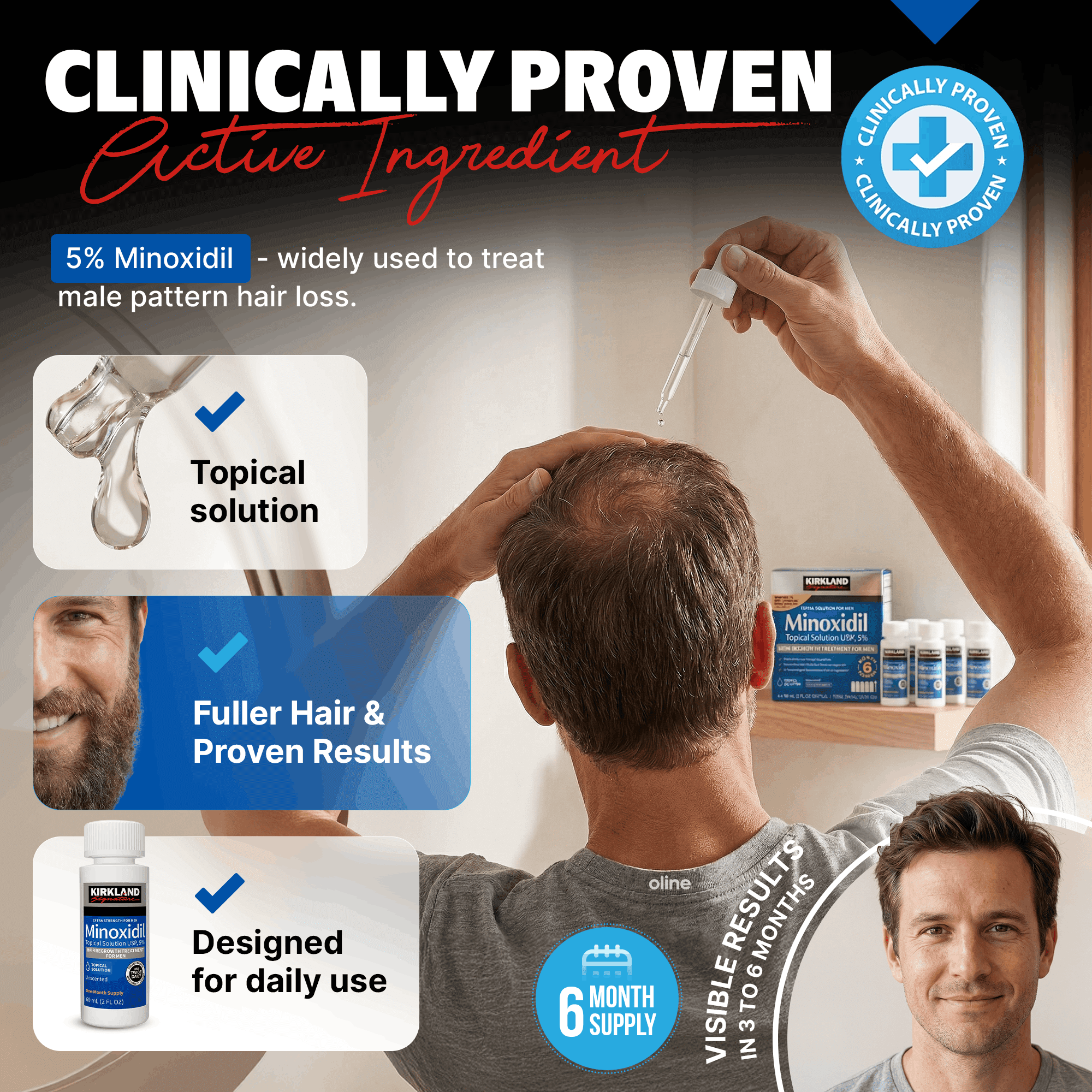 Kirkland Minoxidil 5% for Men, Topical Solution Extra Strength Hair Regrowth Treatment, 6 Months Supply, Total 12 Fl Oz, Premium Dropper Applicator, Exclusive Comb and Bonus Free Guide Included