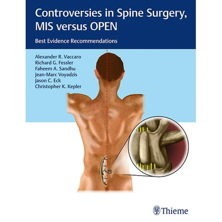 UPC: 9781604068818 | Controversies in Spine Surgery  MIS Versus Open: Best Evidence Recommendations (Hardcover)