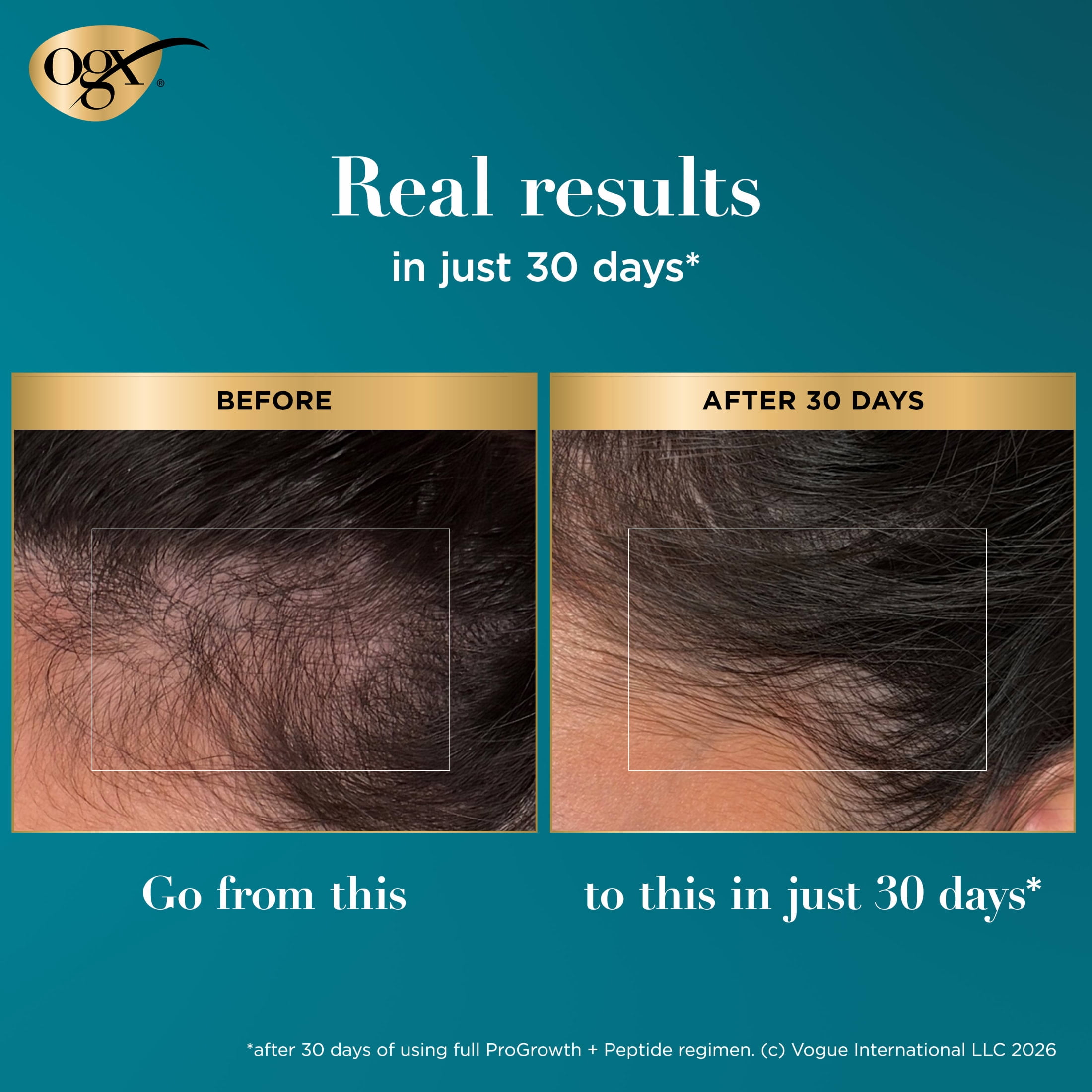 OGX ProGrowth + Peptide Scalp Serum, 0.33 Fl oz