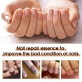 thumbnail image 5 of Health Routin Nail Care Pen, Nail Care Pen Nail Fungus Pen Austria, Cosmetic Care for Nail Fungus Infection Fast & Effective, With Tea Tree Oil, Vitamin E & Aloe Vera (2pcs), 5 of 9