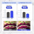 thumbnail image 4 of Mascarilla labial DERMATORY Hyalluron Peptide, volumen 10 ml, 4 of 6