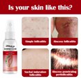 thumbnail image 3 of Body Folliculitis Clearing Spray, Clear Skin Body Cleansing Spray, 3 of 8