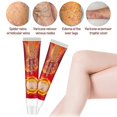 thumbnail image 4 of Sumifun, 10 Uds., ungüento para venas varicosas, yeso médico, tratamiento para el cuidado de la piel, vasculitis, flebitis, araña, varicosidad, angiitis, cremas kaili Sencillez, 4 of 4