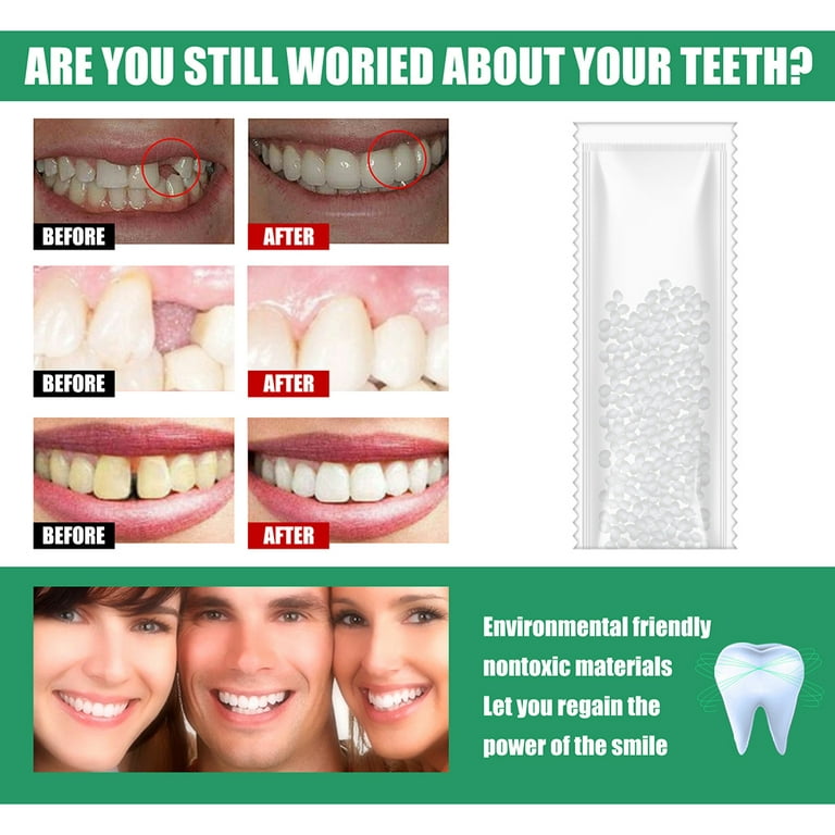 50pcs/box Temporary Tooth Repair Kit-Thermal Beads Fix the Missing, Broken  Teeth