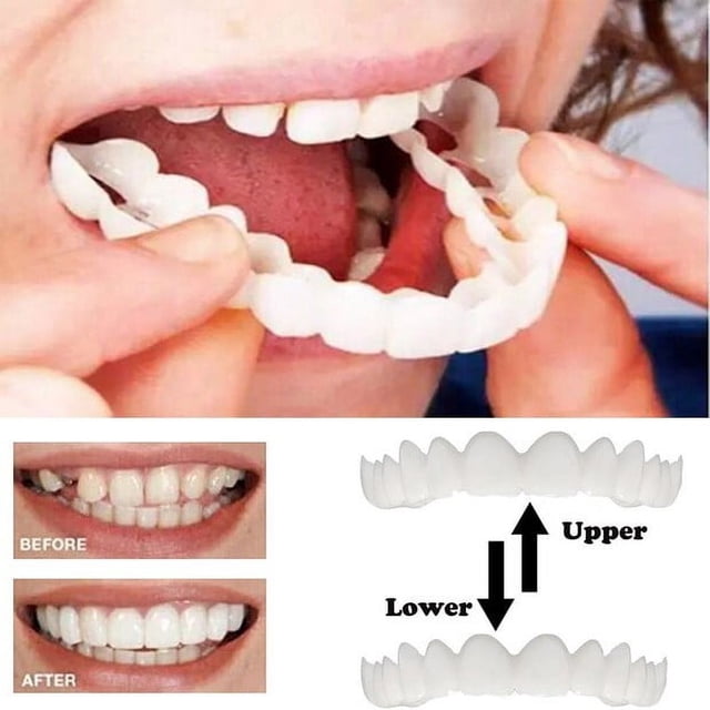 1 unidad de dientes temporales, dentaduras postizas, carillas dentales cosméticas superiores, dentaduras postizas