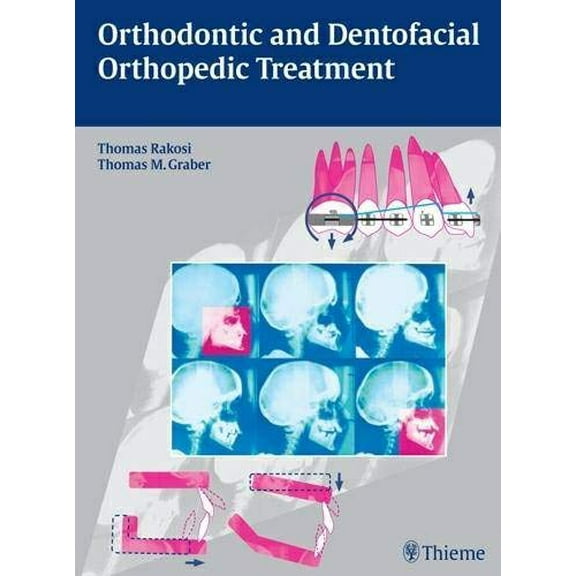 Orthodontic and Dentofacial Orthopedic Treatment, 9783131277619, 3131277610, Hardcover, 1 edition