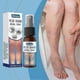 thumbnail image 2 of 1-3x Varicose Veins Treatments for Legs Smoothing Gentle Vein Healing Miracles Spray for Blood Vase Vasculitis Treatments, 2 of 5