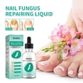 thumbnail image 4 of Aceite de hongo para uñas de los pies líquido reparador de uñas para blanquear las uñas cuidado de los pies, 4 of 9
