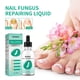 thumbnail image 4 of 30ml Toenail Fungus Oil Nail Care Repair Liquid para blanqueamiento antihongos Ndcxsfigh  Nuevos Originales, 4 of 9