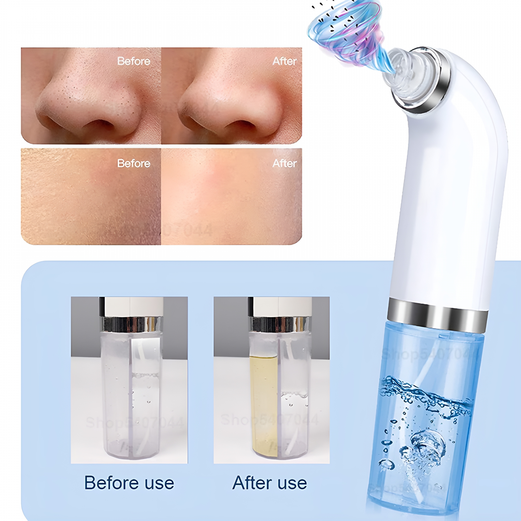 XIRQI Blackhead Remover Pore Vacuum, with 6 Suction Heads Replaceable, Facial Cleaner Beauty Instrument Electric Strong Suction Comedone Extractor Tool for Acne Removal Blackhead Sucker, White
