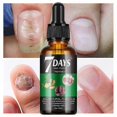 thumbnail image 2 of Nail Health Revitalizer, 7-Day Growth & Strength Serum, Fungal Treatment & Repair Solution for Healthy Nails, 2 of 5