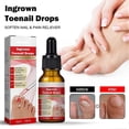 thumbnail image 3 of Ingrown Toenail Repair Essence Gel Nail Surface Improving Liquid For Men Women Nail Treatment, 3 of 5