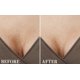 thumbnail image 2 of Paquete de 4 almohadillas antiarrugas en forma de T para el pecho – Parches de silicona antienvejecimiento para la piel para la prevención de arrugas en el pecho, reutilizables – Suaviza y reduce las arrugas de los hombros – Almohadillas antiarrugas reafirmantes de silicona Sincero Electrónica, 2 of 5