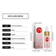 Yolmart 50ML Removing Printing Solution Lightens Marks And Brightens