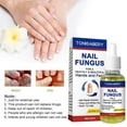2pcs New Nail Fungal Treatment Feet Care Essence Against Fungal Nail