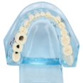 thumbnail image 3 of Modelo patológico Dental enseñanza clara modelo de exhibición de dientes dentales desmontable azul transparente, 3 of 8