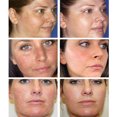 thumbnail image 4 of Crema Para Pecas 20g Suero de piel brillante natural Anti-envejecimiento Eliminación de acné Esencia Productos para el cuidado de la piel Ndcxsfigh Cuidado Belleza, 4 of 9