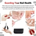thumbnail image 6 of BreaDeep 6PCS Podiatrist Toenail Clippers, Professional Thick Toenail Clippers for Thick & Ingrown Nails, Wide Jaw Opening Nail Clippers Set Toenail Clippers for Ingrown Manicure, Pedicure (Black), 6 of 6