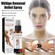 thumbnail image 3 of 30ml Vitiligo Skin Repair Spray For Skin Care, Repair Skin, Vitiligo Care Spray for Reduce White Spots, 3 of 5
