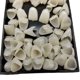 thumbnail image 3 of Superdental, 100 Uds., carillas de corona temporales, Material anterior, parte delantera trasera, dientes molares, 3 of 5