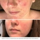 thumbnail image 5 of Exfoliante facial Bioelements Measured Micrograins 120 ml para toda la piel, 5 of 7