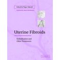 thumbnail image 2 of Uterine Fibroids: Embolization and Other Treatments, 2 of 2