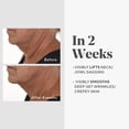 thumbnail image 4 of Murad Retinal ReSculpt Overnight Treatment Refill - Face & Neck Serum, Smooths Wrinkles, Lifts Sagging Skin - 1 fl oz, 4 of 6