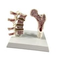 thumbnail image 4 of Modelo de Anatomía de Osteoporosis de Fémur Humano para Suministros Escolares de Enseñanza en El Hogar, 4 of 9