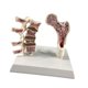 thumbnail image 4 of Modelo de anatomía de osteoporosis de fémur humano Aprenda accesorios de esqueletos Herramienta educativa para suministros escolares enseñando hogar, 4 of 8