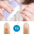 thumbnail image 4 of Clearance!!! Electric Nail Clippers - 2026 Smart Nail Clipper for Seniors, Electric Nail Clipper with LED Light, Painless Toenail Trimmer for Thick Nails, Arthritis, Low Vision, 4 of 5