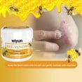 thumbnail image 4 of Crema para psoriasis con veneno de abeja (1/3/5 unidades), alivia el enrojecimiento y la picazón, repara la piel de manos y pies, para todo tipo de piel., 4 of 5