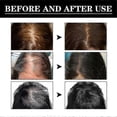thumbnail image 2 of 2pcs Fast Growing Anti Hair Loss Essential Oil Rosemary Hair Grow, 2 of 5
