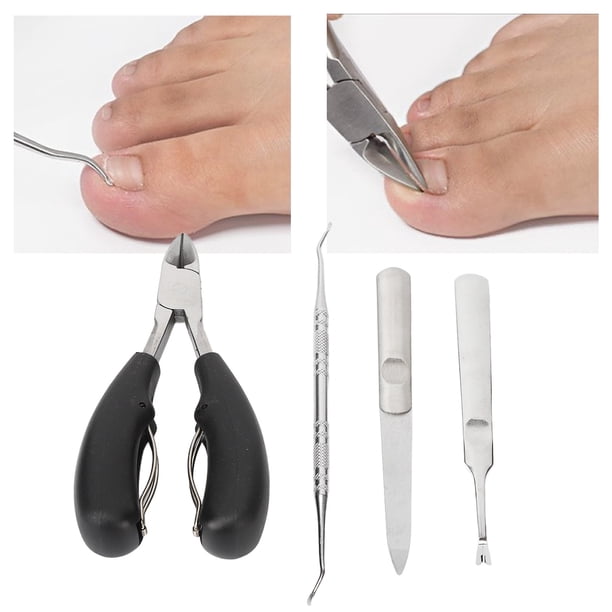 Kit Coupe-Ongles Spécial Jambes/Pieds Parker - Couteau & Coupe-Bords - Acier Carbone - Neuf